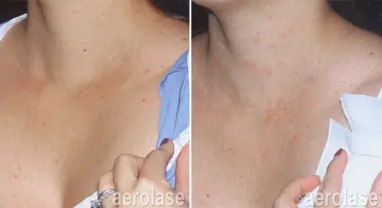 Lesions2 - Pair