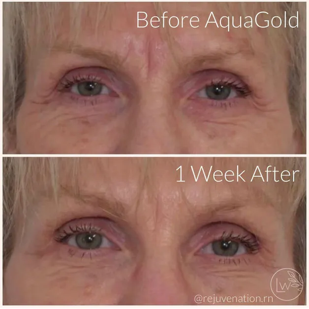 B&A Diamond Glow