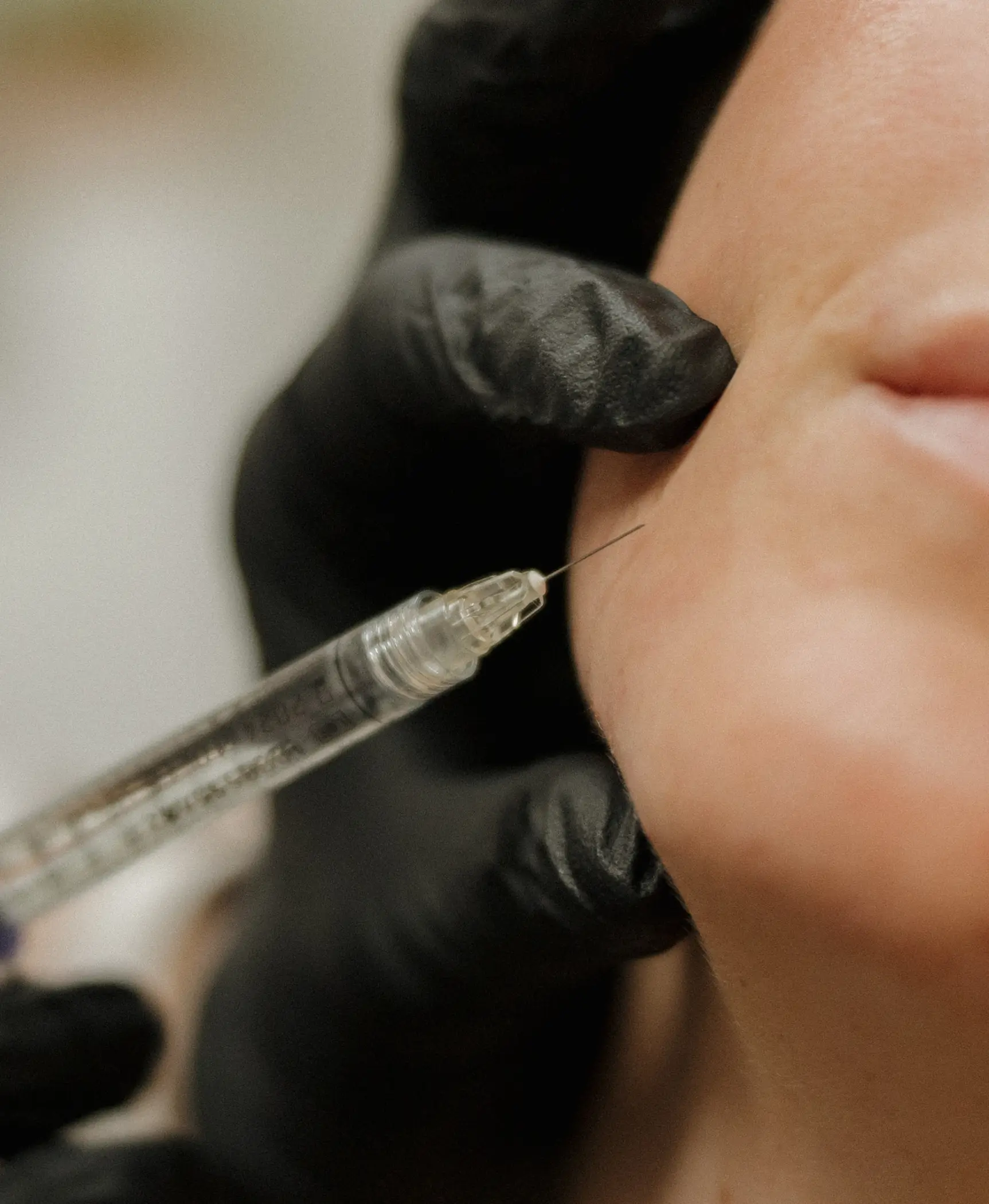 A close-up image of a medical professional administering an injectable treatment to a patient's cheek. The practitioner is wearing black gloves and using a syringe to deliver the substance, likely for cosmetic purposes such as dermal fillers or Botox. The patient's face is partially visible, highlighting the area being treated. This image represents the growing trend of non-surgical cosmetic procedures aimed at enhancing facial aesthetics.