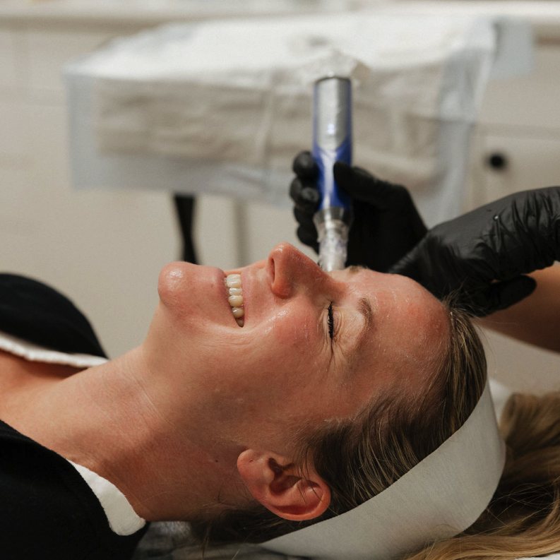 Microglow radiance and glow result