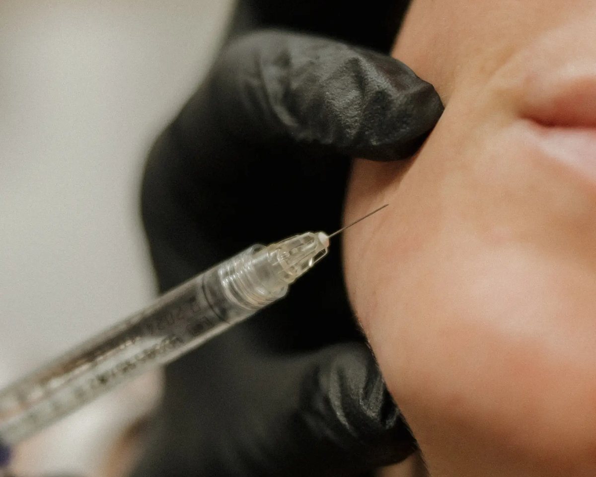 Botox and filler treatment at LiveWell
